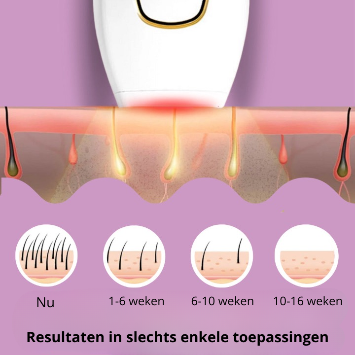 IPL Haarverwijderaar - De Beste Laser-Haarverwijdering voor Thuis